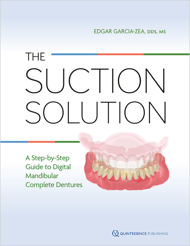 Edgar García-Zea The Suction Solution A Step-by-Step Guide to Digital Mandibular Complete Dentures