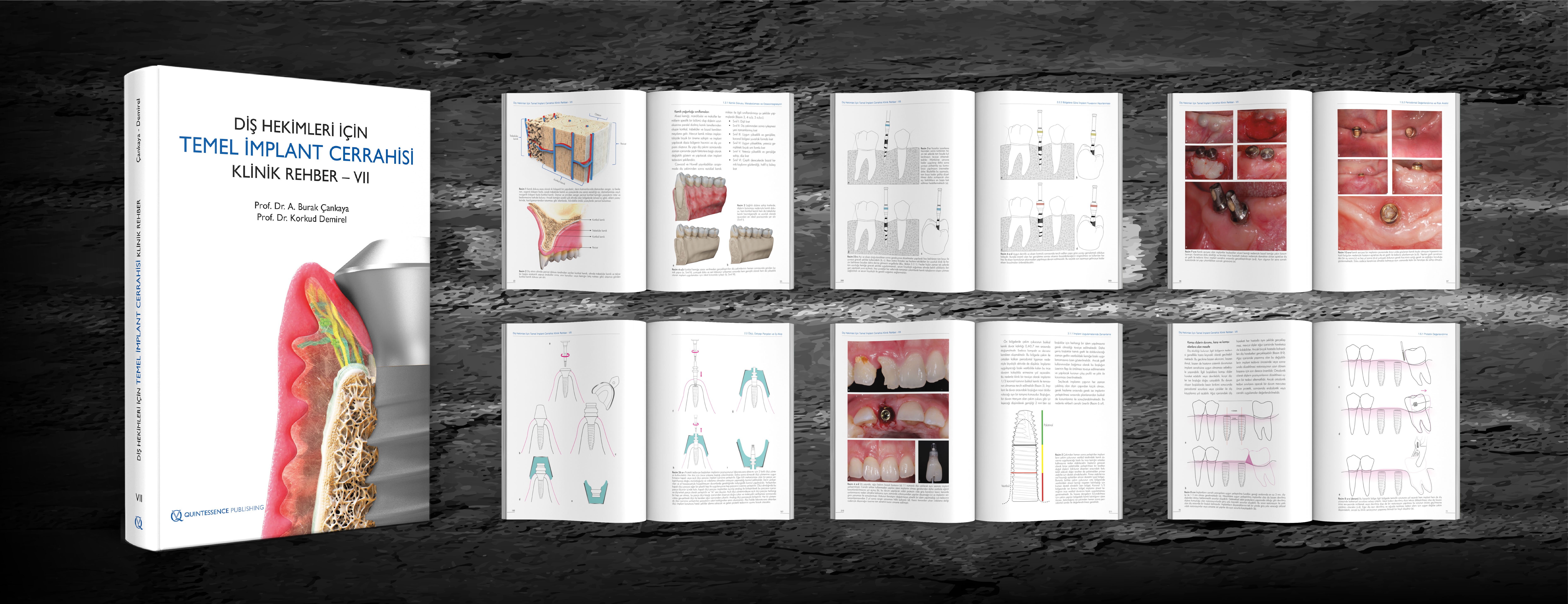 Quintessence Türkiye